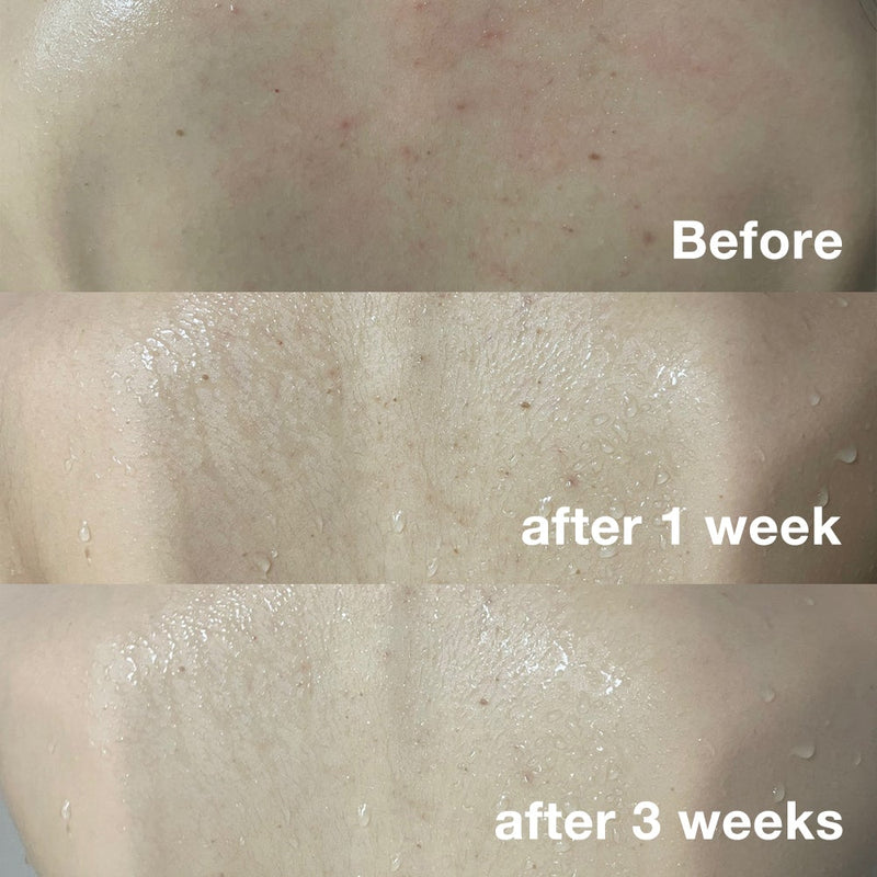 Red Face & Body Cleansing Set - MEDICUBE US